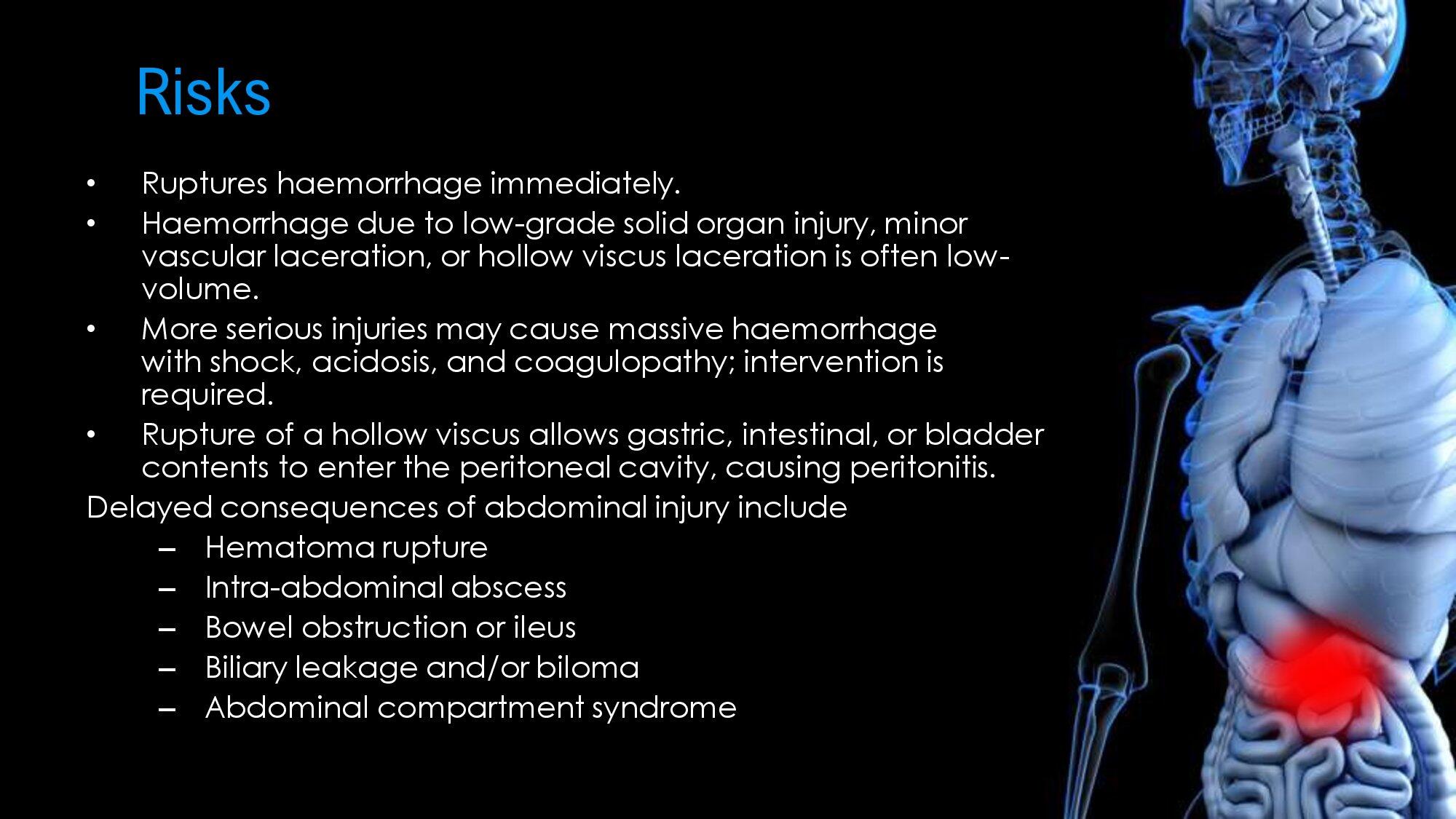 Abdomen Trauma. GRA.19E_0000008