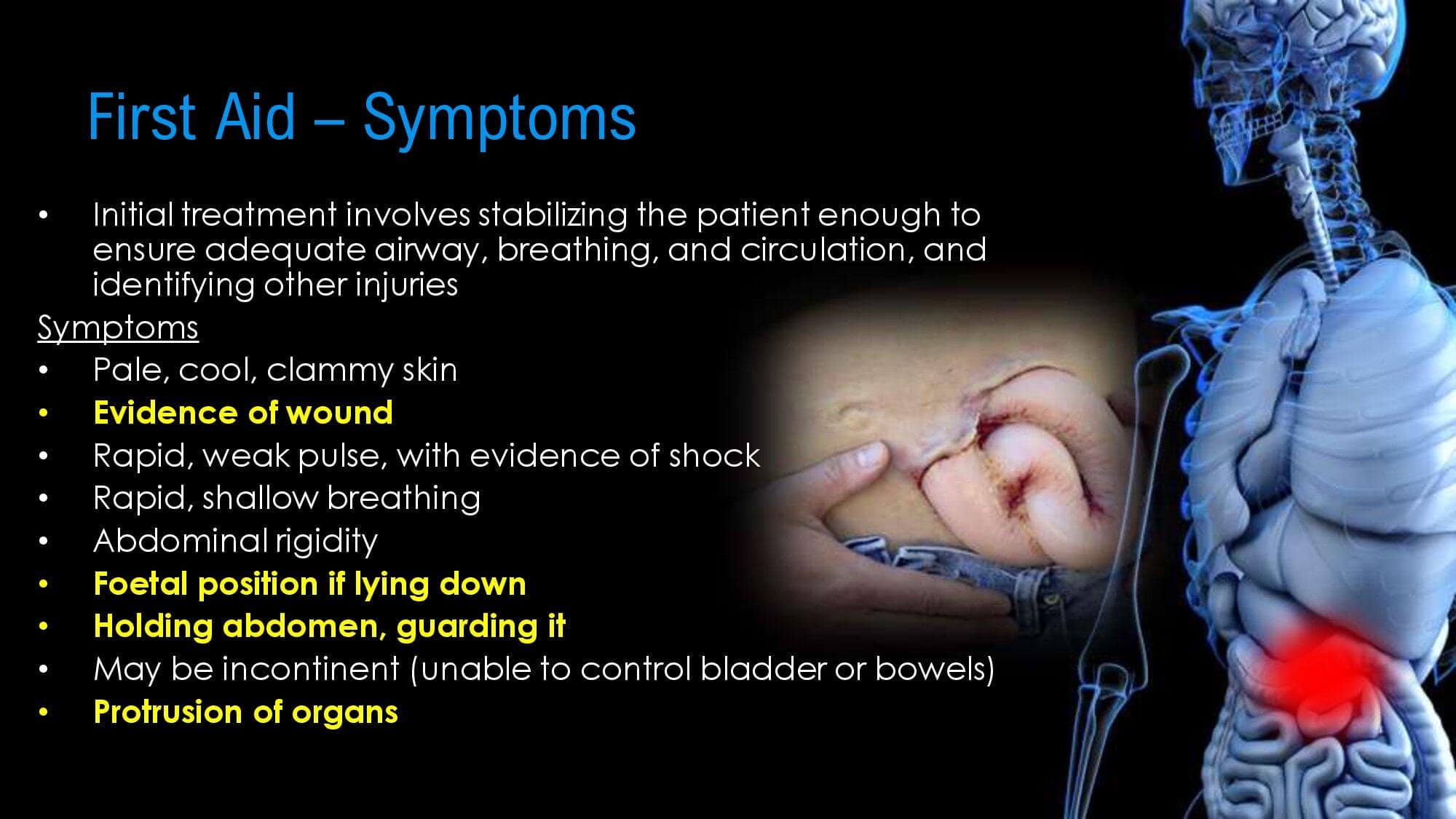 Abdomen Trauma. GRA.19E_0000009