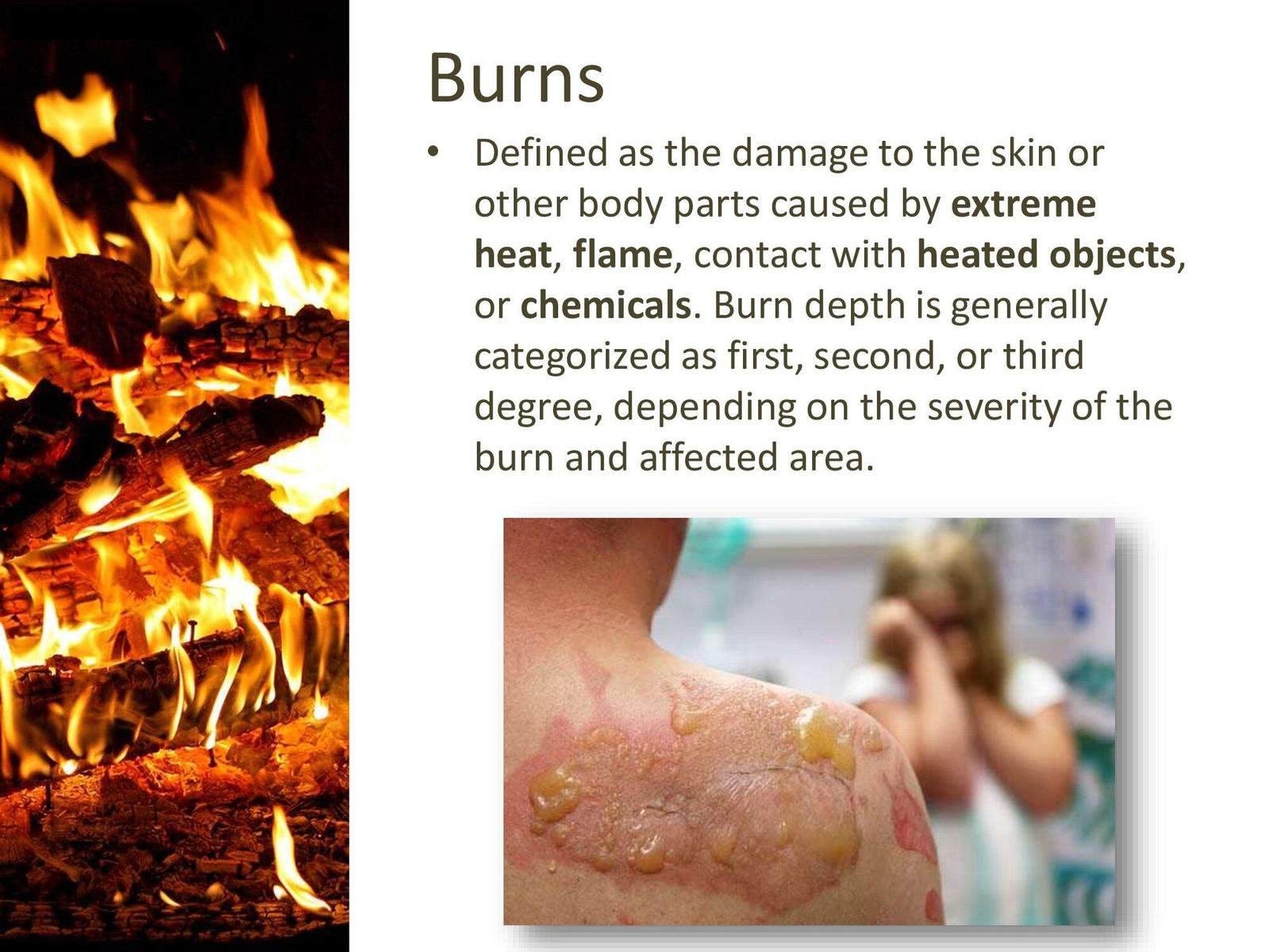 DisasterMed-Burns.R.A_0000003