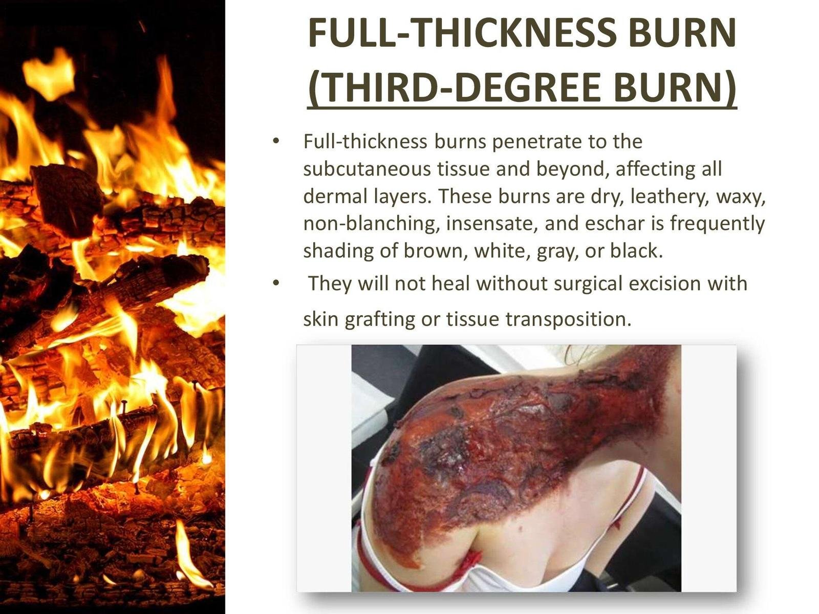DisasterMed-Burns.R.A_0000008